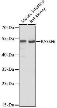 Western blot - RASSF6 Polyclonal Antibody 