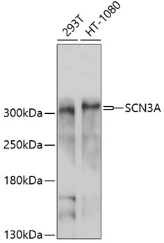 Western blot - SCN3A Polyclonal Antibody 