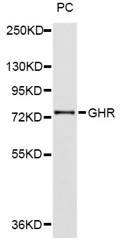 Western blot - GHR Polyclonal Antibody 