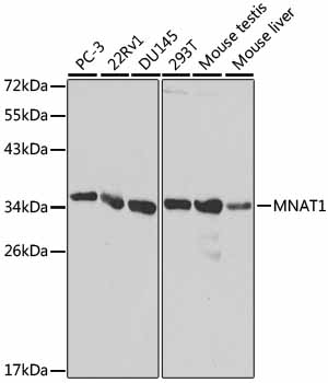 Western blot - MNAT1 Polyclonal Antibody 