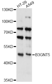 Western blot - B3GNT5 Polyclonal Antibody 