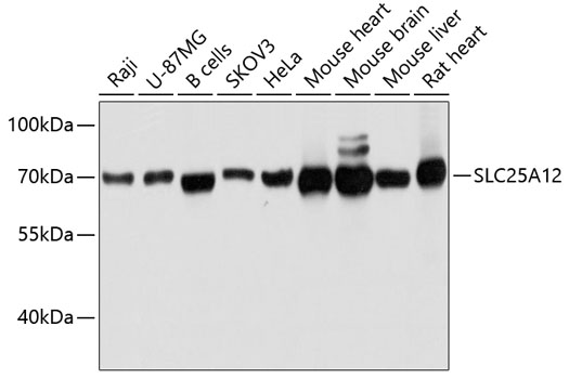 Western blot - SLC25A12 Polyclonal Antibody 