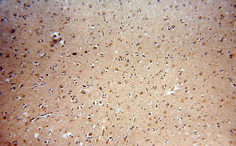 Immunohistochemical of paraffin-embedded human brain using Catalog No:107594(SMN2 antibody) at dilution of 1:50 (under 10x lens)