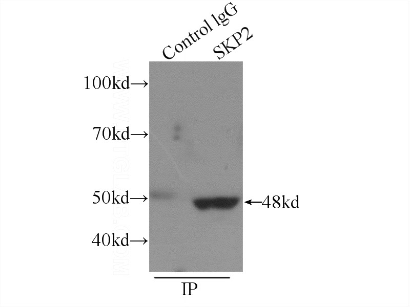 IP Result of anti-SKP2 (IP:Catalog No:115290, 4ug; Detection:Catalog No:115290 1:300) with HEK-293 cells lysate 2440ug.