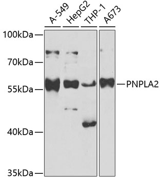 Western blot - PNPLA2 Polyclonal Antibody 