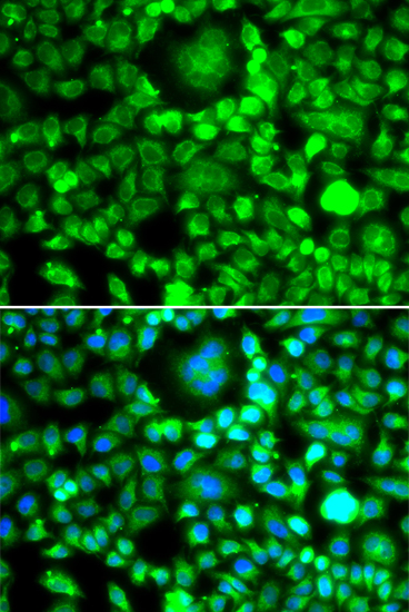 Immunofluorescence - BLID Polyclonal Antibody 