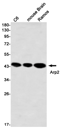 Western blot detection of Arp2 in C6,mouse Brain,Ramos using Arp2 Rabbit mAb(1:1000 diluted)