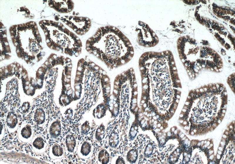 Immunohistochemistry of paraffin-embedded human small intestine tissue slide using Catalog No:113546(P2RY13 Antibody) at dilution of 1:50 (under 10x lens)