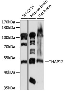 Western blot - THAP12 Polyclonal Antibody 