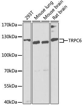 Western blot - TRPC6 Polyclonal Antibody 