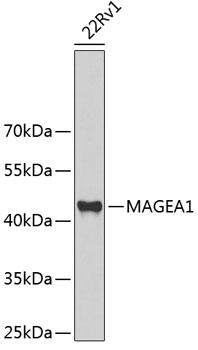 Western blot - MAGEA1 Polyclonal Antibody 