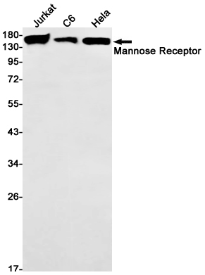 Western blot detection of Mannose Receptor in Jurkat,C6,Hela cell lysates using Mannose Receptor Rabbit mAb(1:1000 diluted).Predicted band size:166kDa.Observed band size:166kDa.