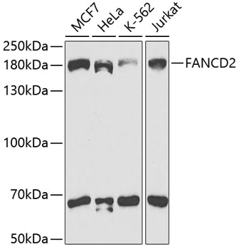 Western blot - FANCD2 Polyclonal Antibody 