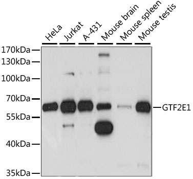Western blot - GTF2E1 Polyclonal Antibody 
