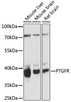 Western blot - PTGFR Polyclonal Antibody 