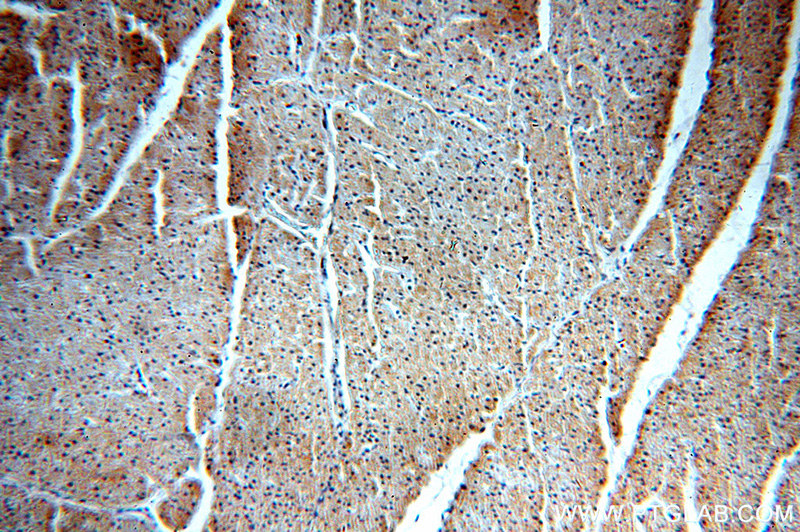 Immunohistochemical of paraffin-embedded human heart using Catalog No:116783(PIK3C3 antibody) at dilution of 1:100 (under 10x lens)