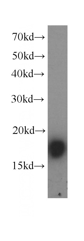 human stomach tissue were subjected to SDS PAGE followed by western blot with Catalog No:107298(GKN1 antibody) at dilution of 1:400