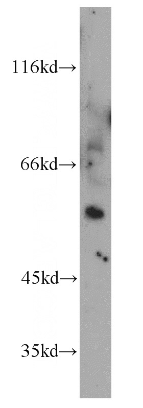 mouse brain tissue were subjected to SDS PAGE followed by western blot with Catalog No:115213(SESN1 antibody) at dilution of 1:500