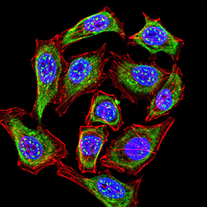 Fig3: Immunocytochemistry staining of KMT2C in Hela cells (green). Formalin fixed cells were permeabilized with 0.1% Triton X-100 in TBS for 10 minutes at room temperature and blocked with 1% Blocker BSA for 15 minutes at room temperature. Cells were probed with the primary antibody ( 1/100) for 1 hour at room temperature, washed with PBS. Alexa Fluor®488 Goat anti-Mouse IgG was used as the secondary antibody at 1/1,000 dilution. The nuclear counter stain is DAPI (blue), Actin filaments have been labeled with Alexa Fluor- 555 phalloidin (red).