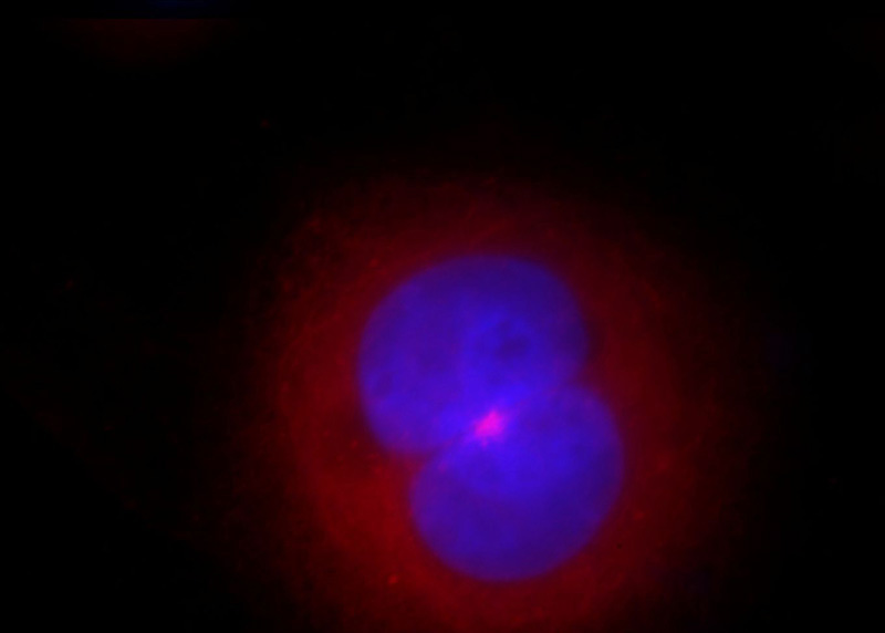 Immunofluorescent analysis of Hela cells, using CEP72 antibody Catalog No:109186 at 1:25 dilution and Rhodamine-labeled goat anti-rabbit IgG (red). Blue pseudocolor = DAPI (fluorescent DNA dye).