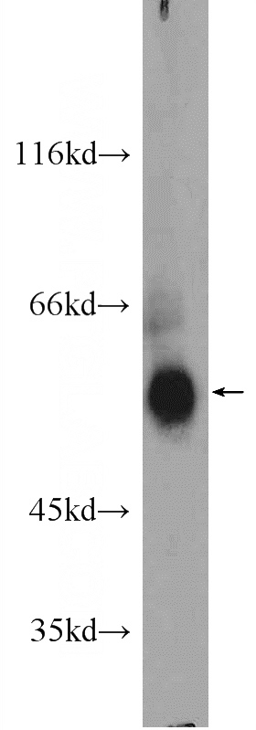 mouse brain tissue were subjected to SDS PAGE followed by western blot with Catalog No:112087(KLHDC5 Antibody) at dilution of 1:1000