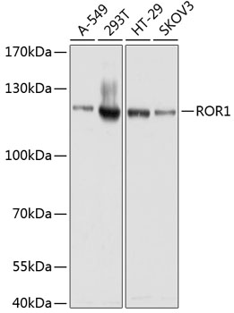 Western blot - ROR1 Polyclonal Antibody 