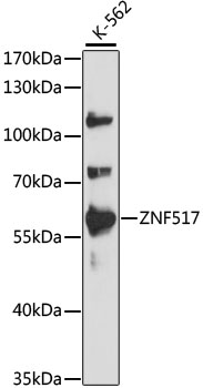 Western blot - ZNF517 Polyclonal Antibody 