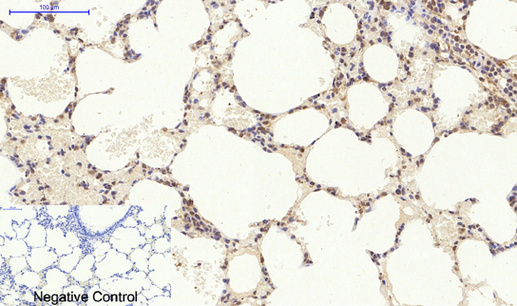 Immunohistochemical analysis of paraffin-embedded Rat-lung tissue. Synapsin I Polyclonal Antibody was diluted at 1:200(4°C,overnight). Sodium citrate pH 6.0 was used for antibody retrieval(>98°C,20min)