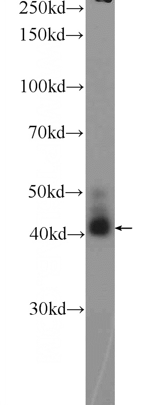 mouse brain tissue were subjected to SDS PAGE followed by western blot with Catalog No:117077(AWAT2 Antibody) at dilution of 1:600