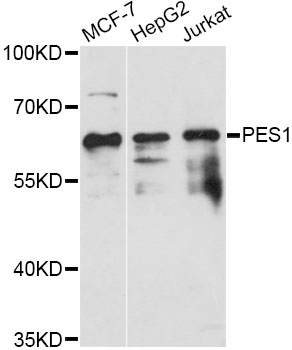 Western blot - PES1 Polyclonal Antibody 
