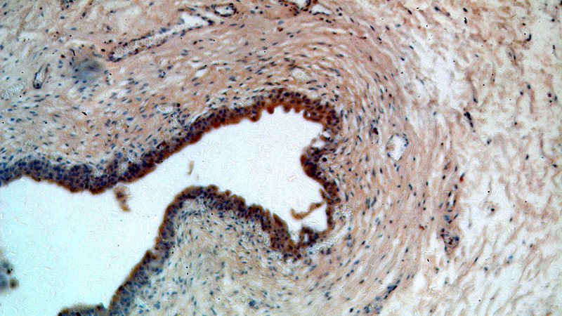 Immunohistochemical of paraffin-embedded human bladder using Catalog No:112978(MYO16 antibody) at dilution of 1:50 (under 10x lens)
