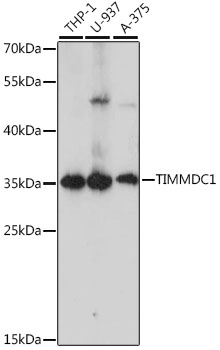 Western blot - TIMMDC1 Polyclonal Antibody 