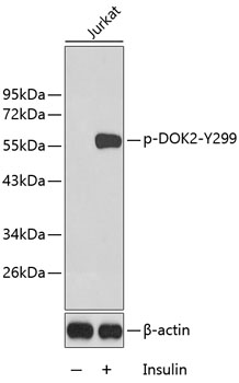 Western blot - Phospho-DOK2-Y299 pAb 
