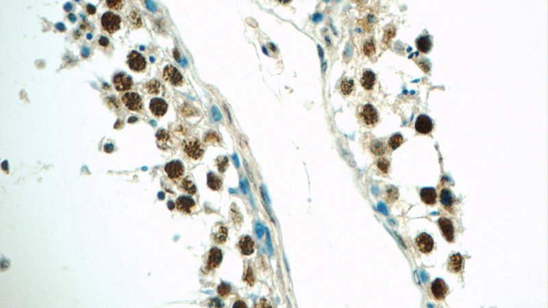 Immunohistochemistry of paraffin-embedded human testis tissue slide using Catalog No:110414(EXOSC8 Antibody) at dilution of 1:50 (under 40x lens)