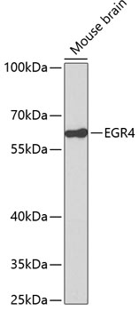 Western blot - EGR4 Polyclonal Antibody 