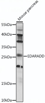 Western blot - EDARADD Polyclonal Antibody 