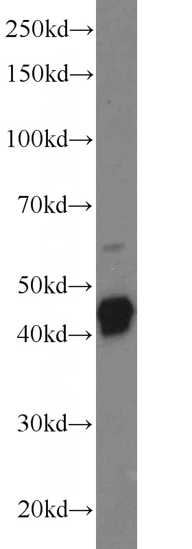 mouse brain tissue were subjected to SDS PAGE followed by western blot with Catalog No:110944(GFAP antibody) at dilution of 1:1000