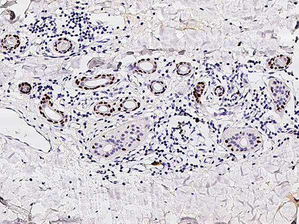 p63 (ΔN) Antibody, Rabbit PAb, Antigen Affinity Purified, Immunohistochemistry