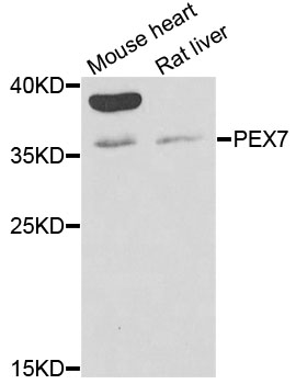 Western blot - PEX7 Polyclonal Antibody 