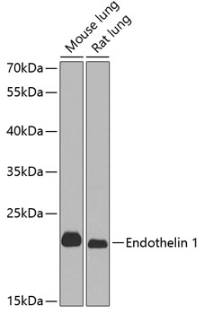 Western blot - Endothelin 1 Polyclonal Antibody 