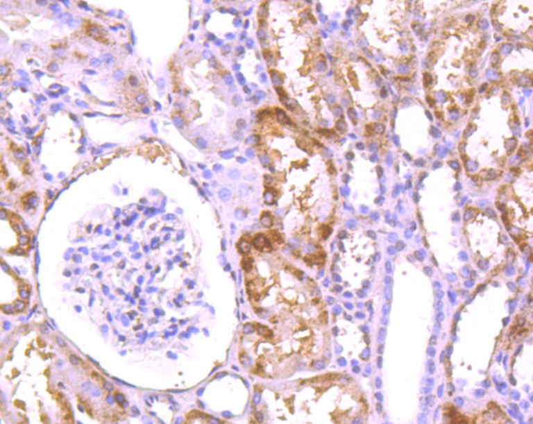 Fig4: Immunohistochemical analysis of paraffin-embedded human kidney tissue using anti-LRRK1 antibody. Counter stained with hematoxylin.