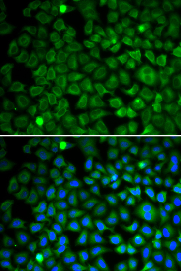 Immunofluorescence - NUP62 Polyclonal Antibody 