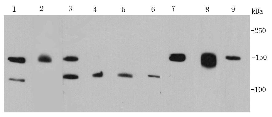 Fig1: Western blot analysis of FGFR2 on different cell lysates using anti-FGFR2 antibody at 1/500 dilution.; Positive control:; Lane 1: MCF-7; Lane 2: K562; Lane 3: Hela; Lane 4: HepG2; Lane 5: A431; Lane 6: A549; Lane 7: NIH/3T3; Lane 8: Jurkat; Lane 9: Mouse brain