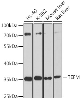 Western blot - TEFM Polyclonal Antibody 