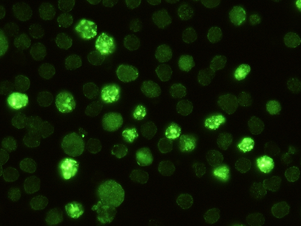 RBP4 Antibody, Rabbit MAb, Immunofluorescence