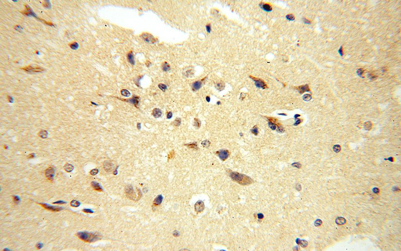 Immunohistochemical of paraffin-embedded human brain using Catalog No:114475(RASGEF1A antibody) at dilution of 1:100 (under 40x lens)