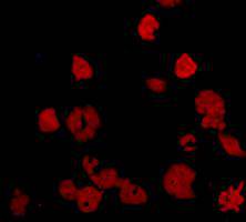 Fig2: Immunofluorescent staining of Hela cells using anti-KIAA0100 Mouse mAb (Cat. # 176654#).