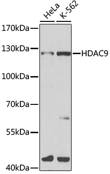 Western blot - HDAC9 Polyclonal Antibody 