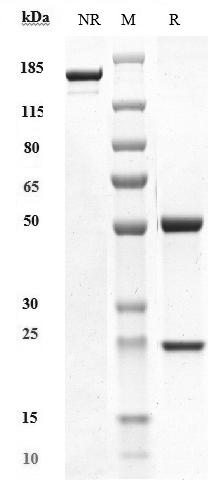 SDS-PAGE