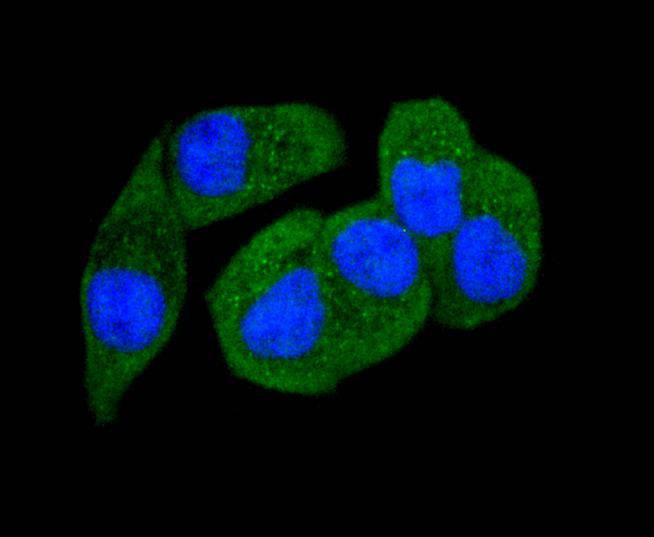 Fig2:; ICC staining of Phospho-PAK1(S144)+PAK2(S141)+PAK3(S139) in Hela cells (green). Formalin fixed cells were permeabilized with 0.1% Triton X-100 in TBS for 10 minutes at room temperature and blocked with 1% Blocker BSA for 15 minutes at room temperature. Cells were probed with the primary antibody ( 1/50) for 1 hour at room temperature, washed with PBS. Alexa Fluor®488 Goat anti-Rabbit IgG was used as the secondary antibody at 1/1,000 dilution. The nuclear counter stain is DAPI (blue).